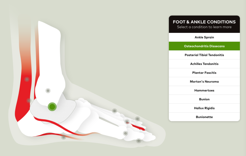 Foot___Ankle_Conditions___Orthopedic_Foot___Ankle