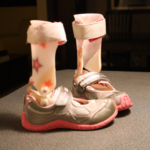 Parents file human rights complaint after girl with leg braces barred from...