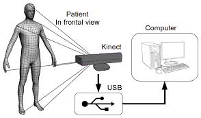  Improved front-view tracking Kinect data for MS