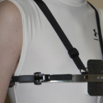 10-year study shows brace treatment is best for Pectus carinatum