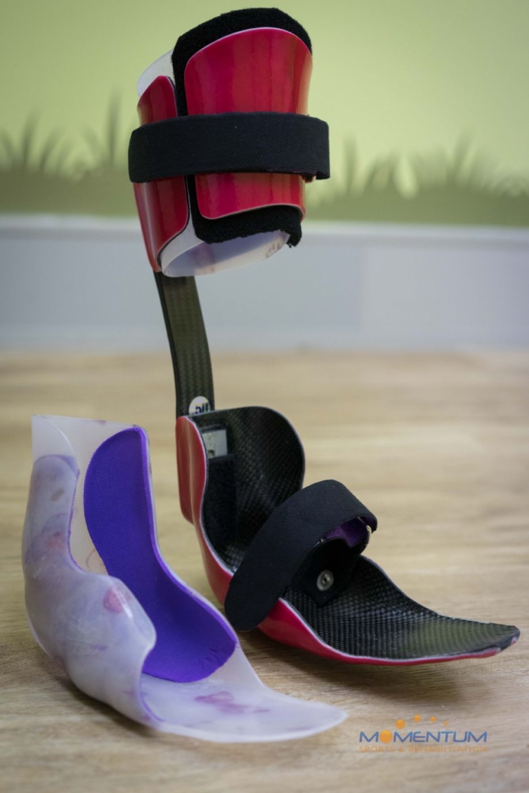 Carbon fiber AFO-SMO orthoses improved gait in patient with cerebral ...