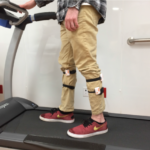 Wearable sensors characterize CP gait