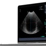 Phantom: the first ultrasound for the Mac