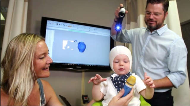 Does your baby need helmet therapy? 5 facts about flat head syndrome