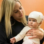 Helmet therapy for infant positional skull deformation 'should be discoura...