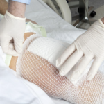 Knee replacement timing is all wrong for most