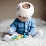 What parents need to know about a baby helmet