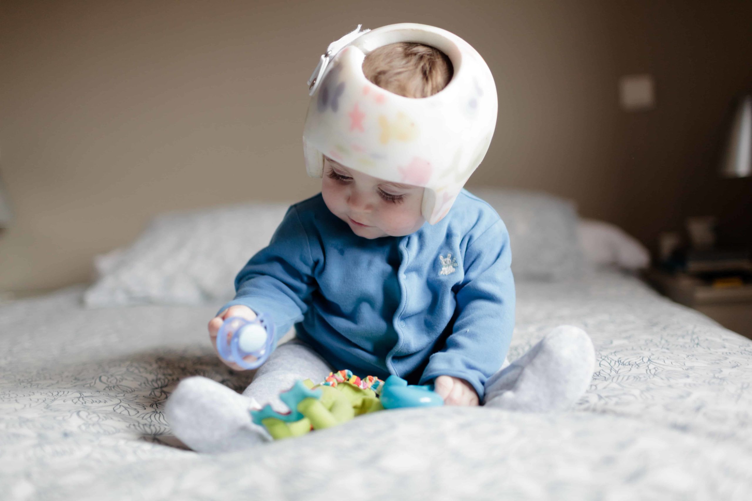 Does your baby need helmet therapy? 5 facts about flat head