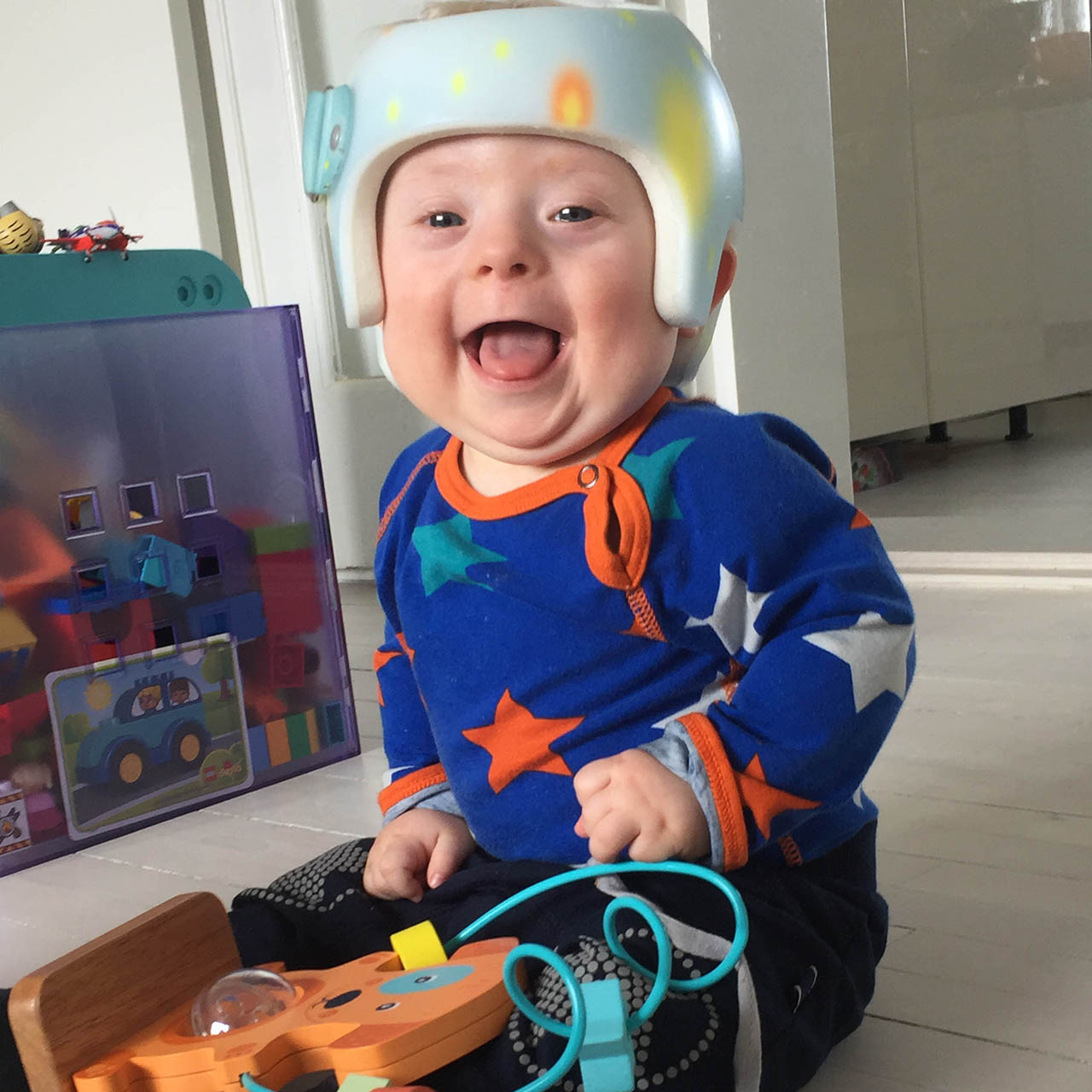Does My Infant Need a Helmet? Understanding Positional Plagiocephaly