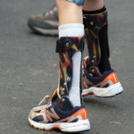 Disease severity, walking needs may guide patients’ orthosis choice