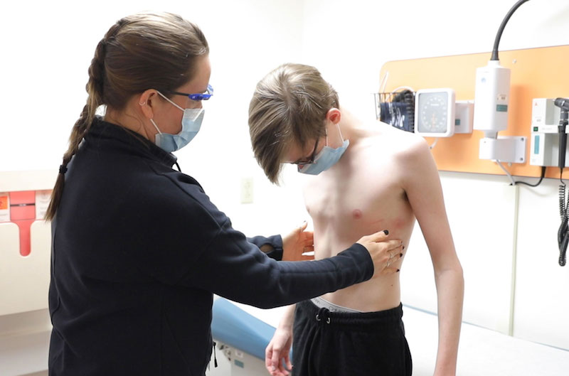 10-year study shows brace treatment is best for Pectus carinatum