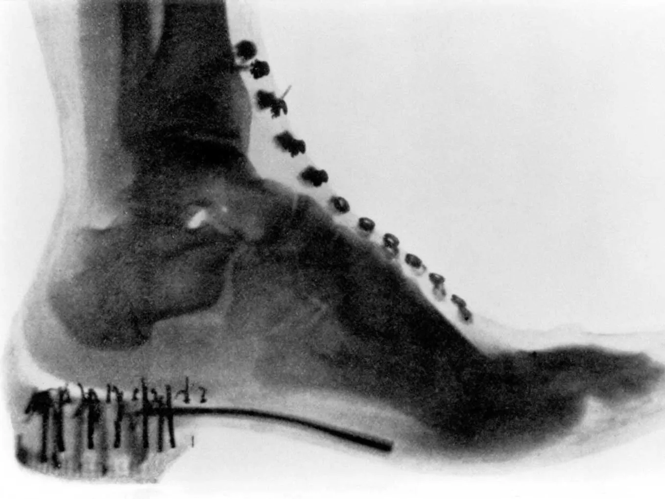 X-Ray Shoe-Fitting Machine - America Comes Alive